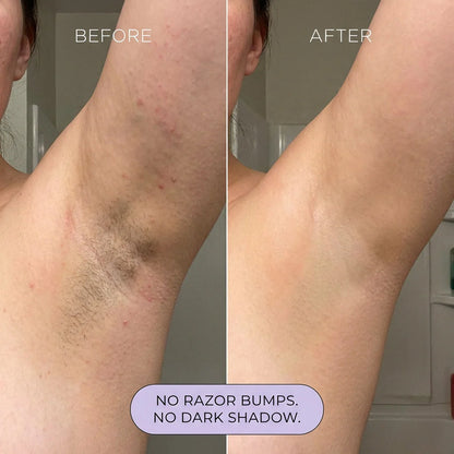 Spray Depilatorio Madwish™ – Indoloro y Rápido